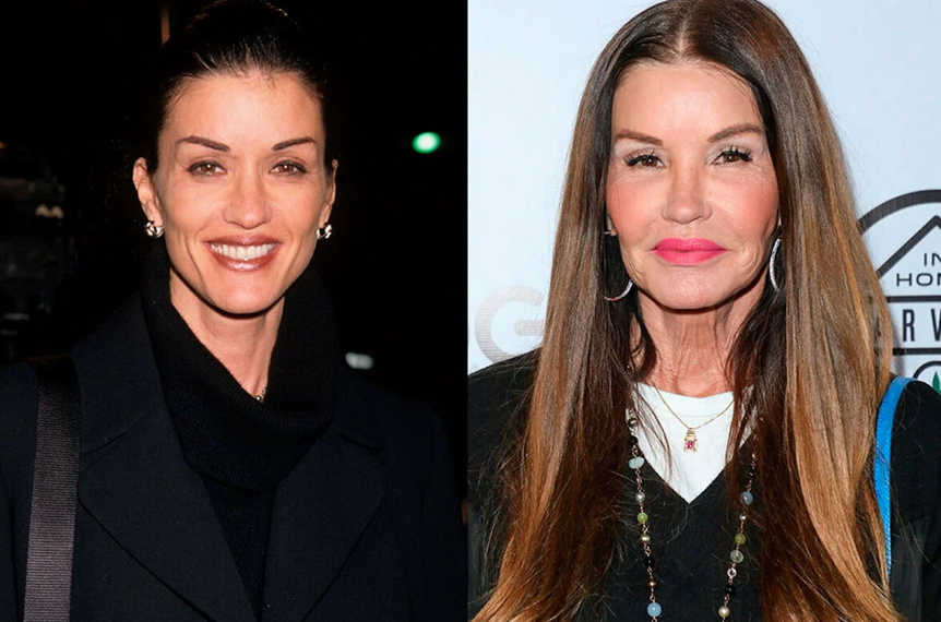 Звезды, которые легли под нож, и изменились до неузнаваемости