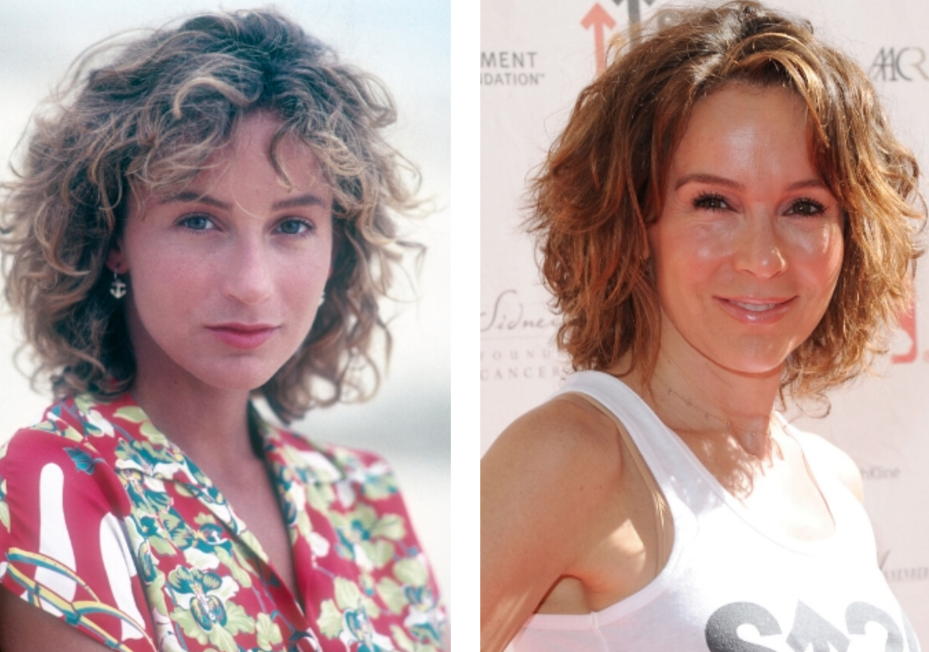 Звезды, которые легли под нож, и изменились до неузнаваемости