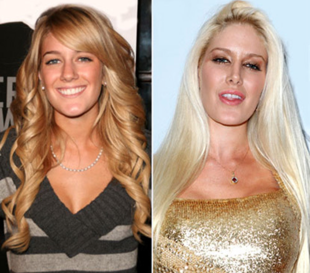 Звезды, которые легли под нож, и изменились до неузнаваемости