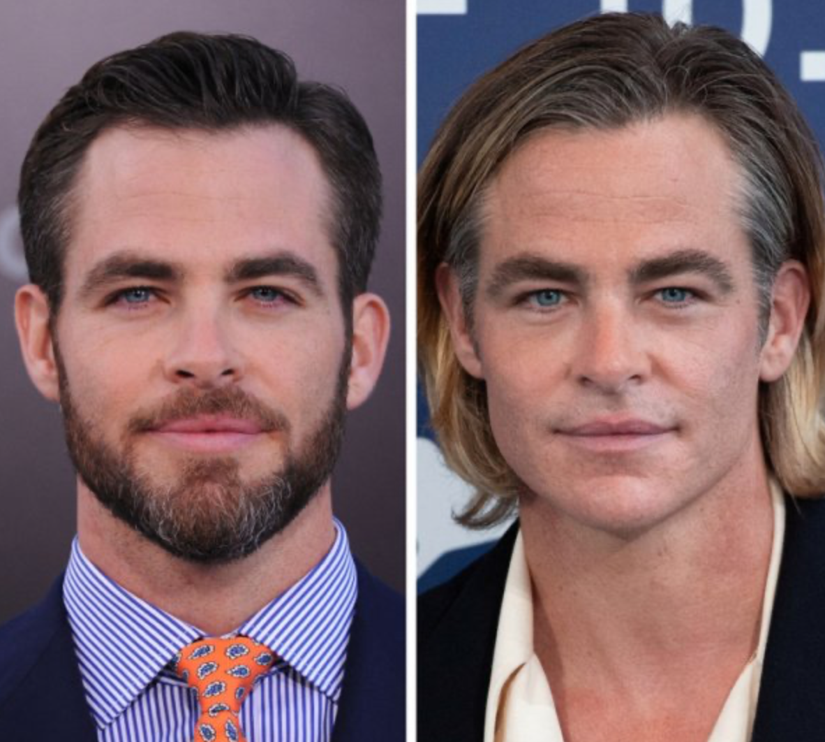 Знаменитости, которых с годами стало не узнать