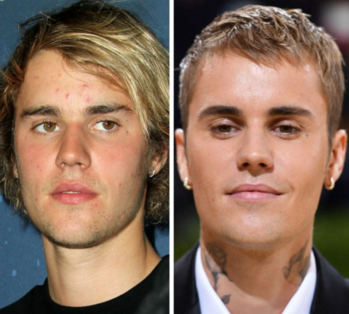 Знаменитости, которых с годами стало не узнать