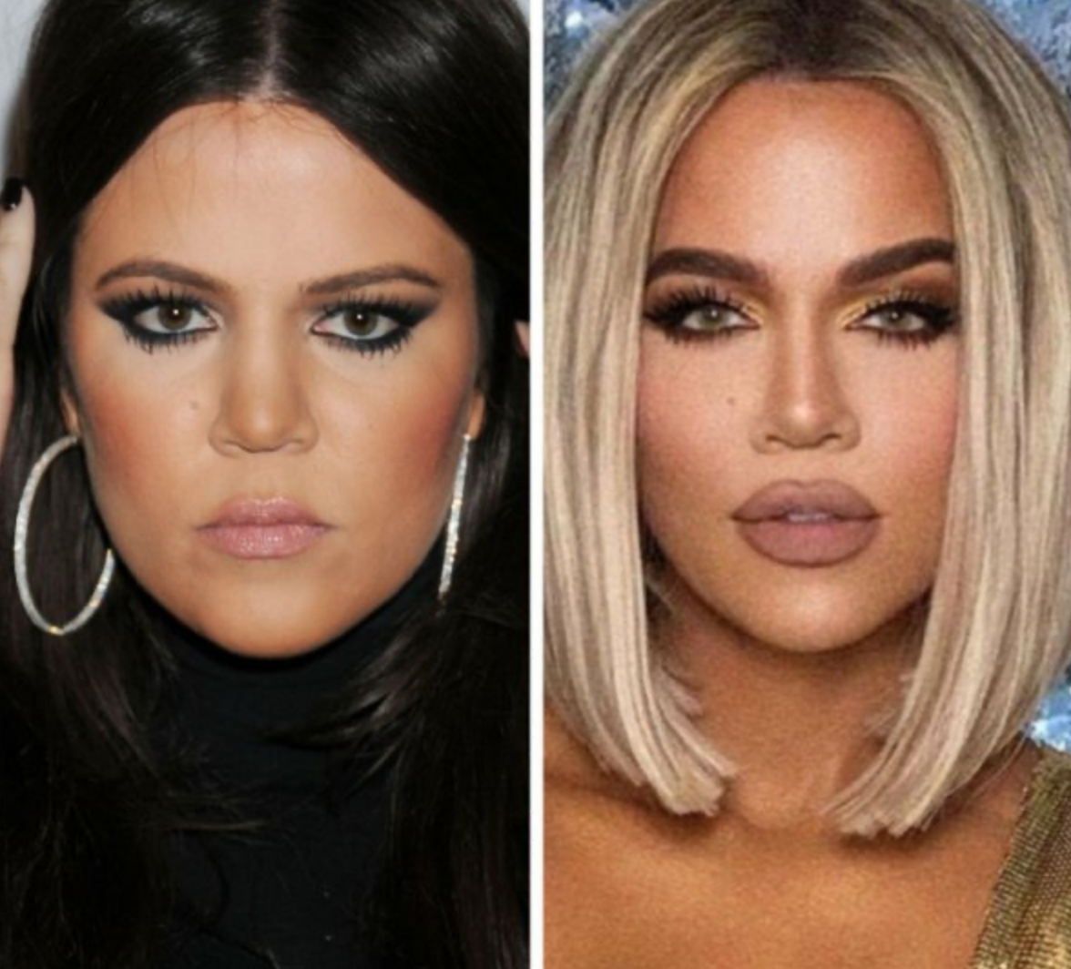 Знаменитости, которых с годами стало не узнать