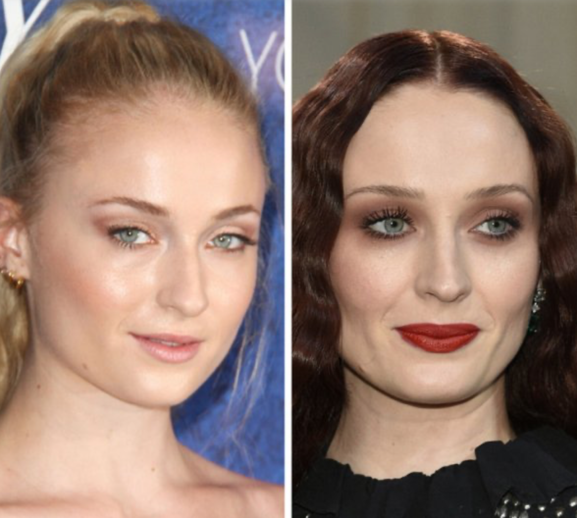 Знаменитости, которых с годами стало не узнать