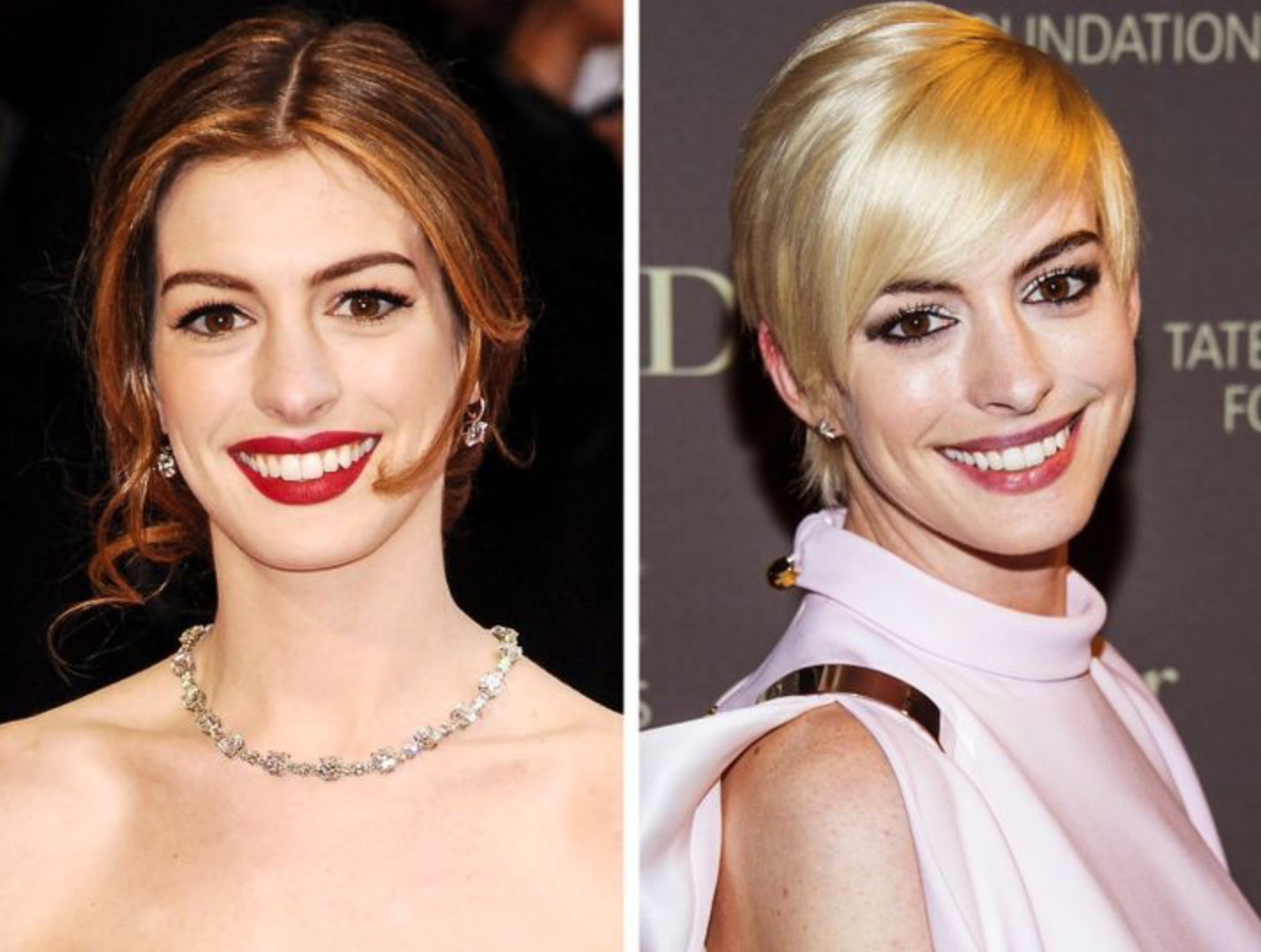 Знаменитости, которых с годами стало не узнать