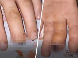 Под Иркутском школьники оторвали палец однокласснику и затоптали его