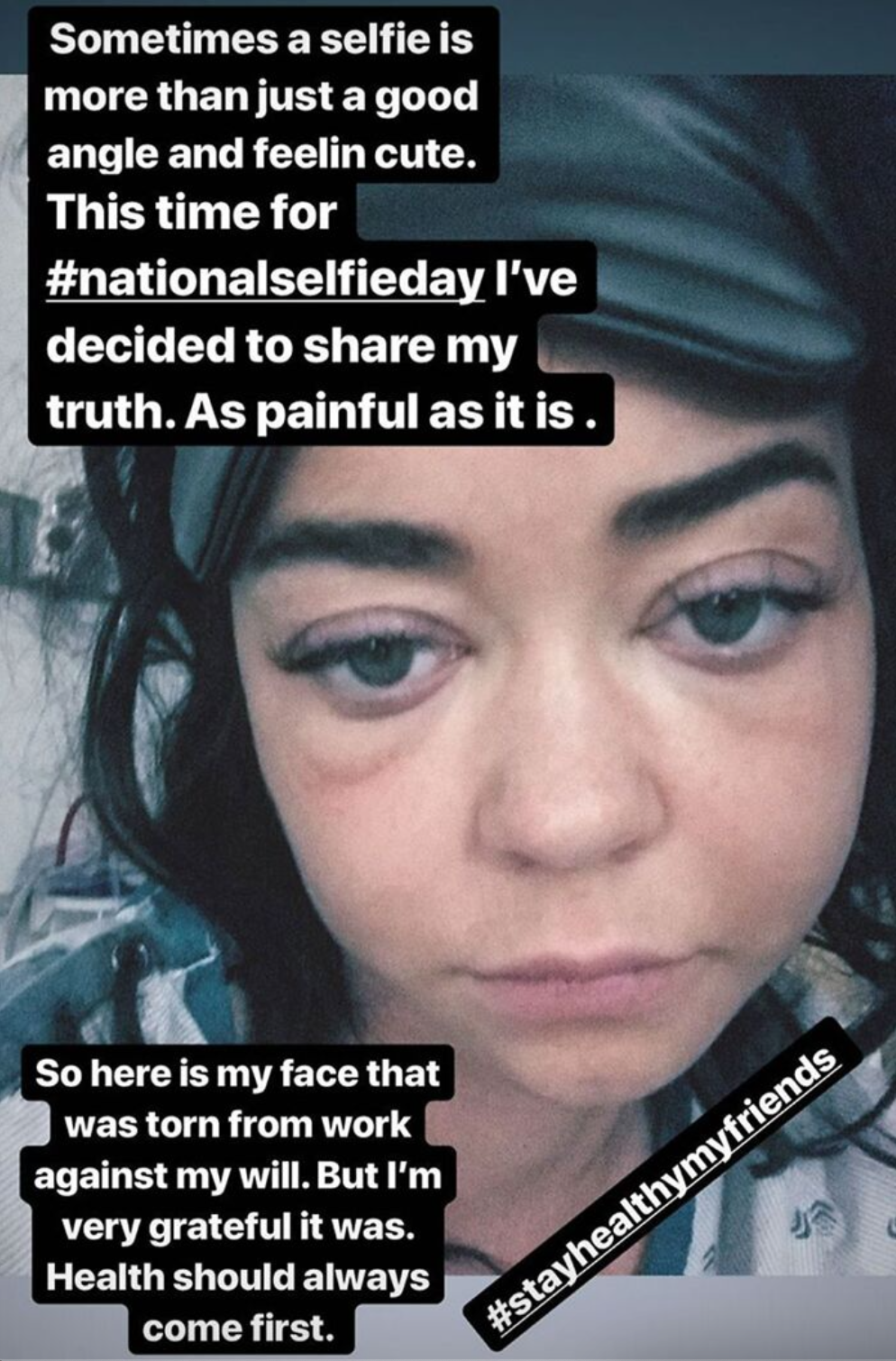 Знаменитости и их фото в соцсетях без фильтра