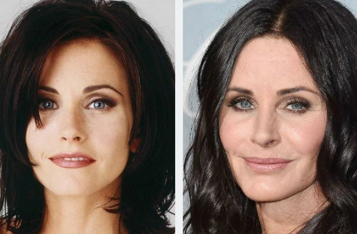 Звезды до и после пластики: найдите отличия