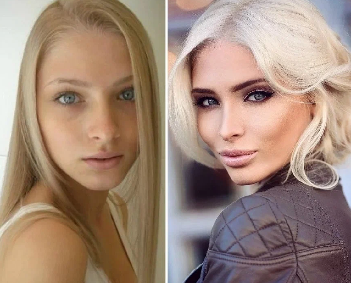 Звезды до и после пластики: найдите отличия