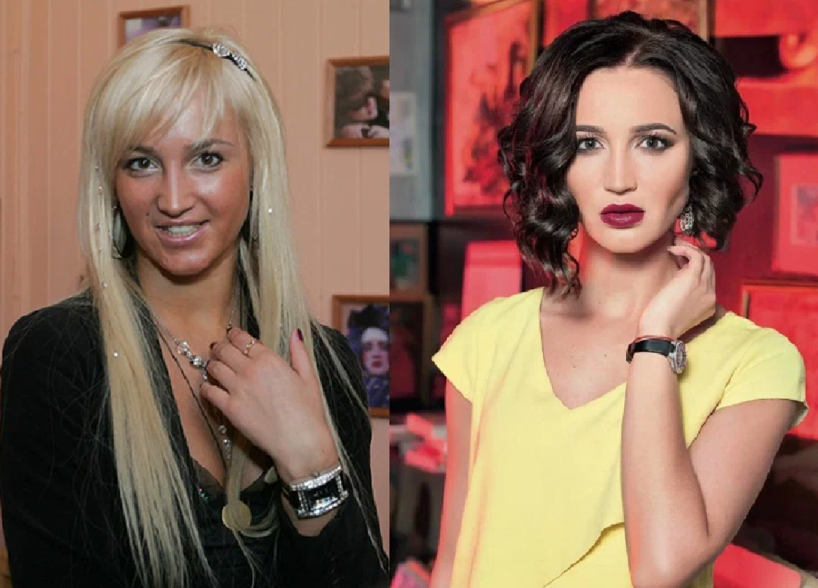 Звезды до и после пластики: найдите отличия