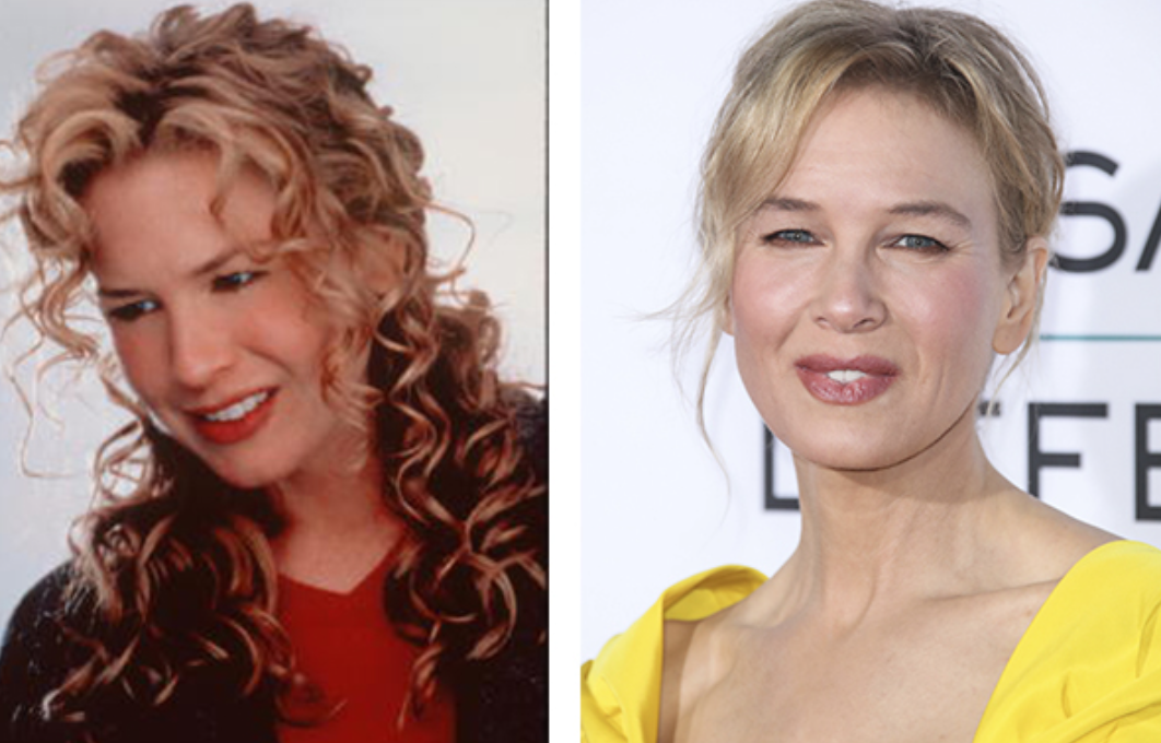 Звезды до и после пластики: найдите отличия