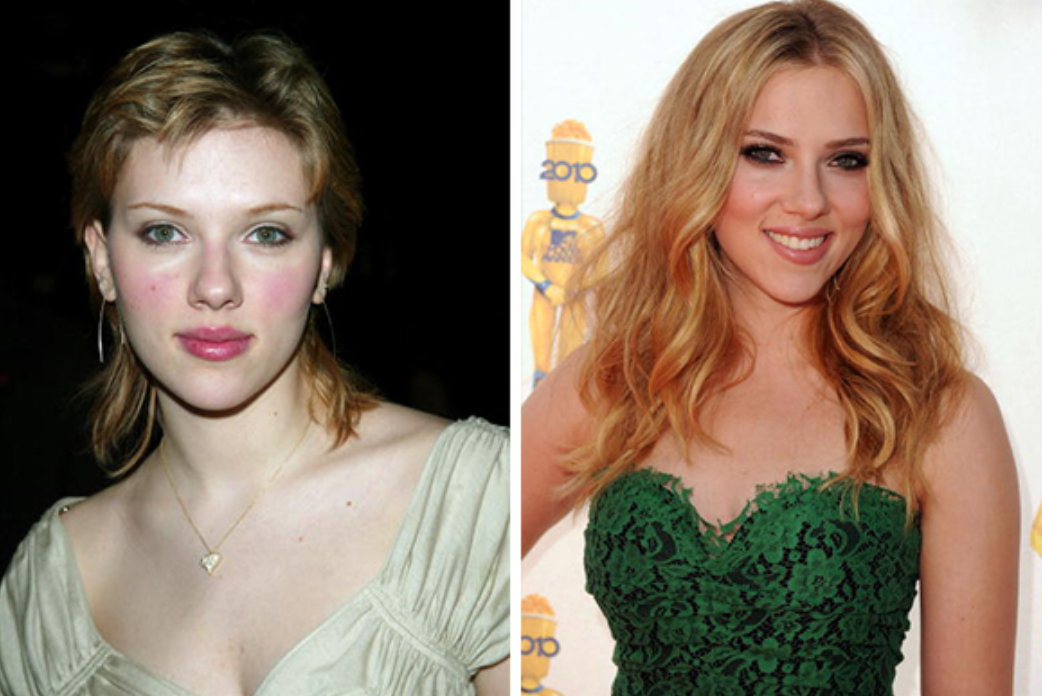 Звезды до и после пластики: найдите отличия