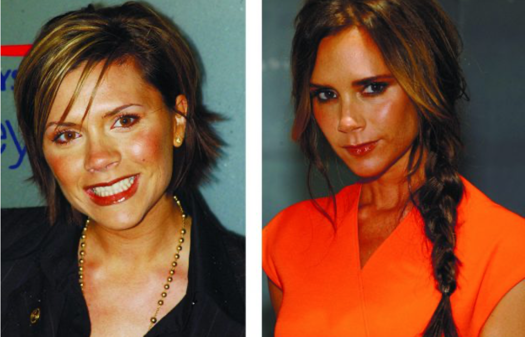 Звезды до и после пластики: найдите отличия