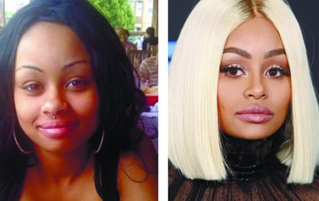 Звезды до и после пластики: найдите отличия