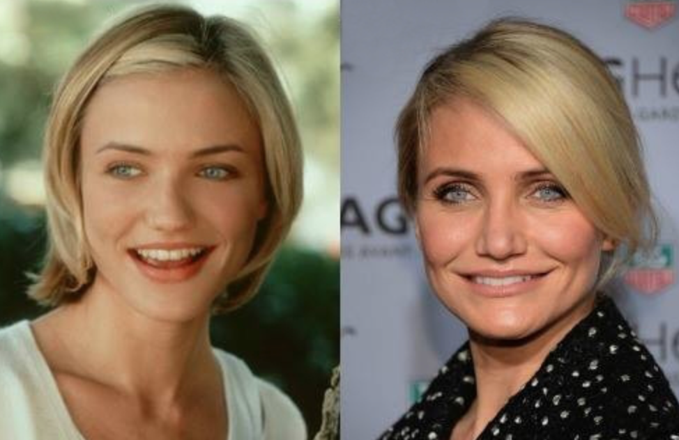 Звезды до и после пластики: найдите отличия