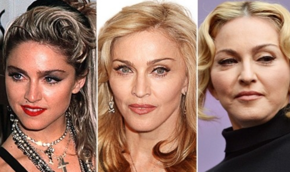 Звезды до и после пластики: найдите отличия