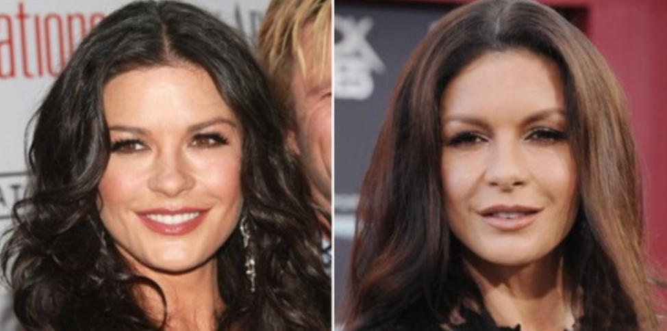 Звезды до и после пластики: найдите отличия