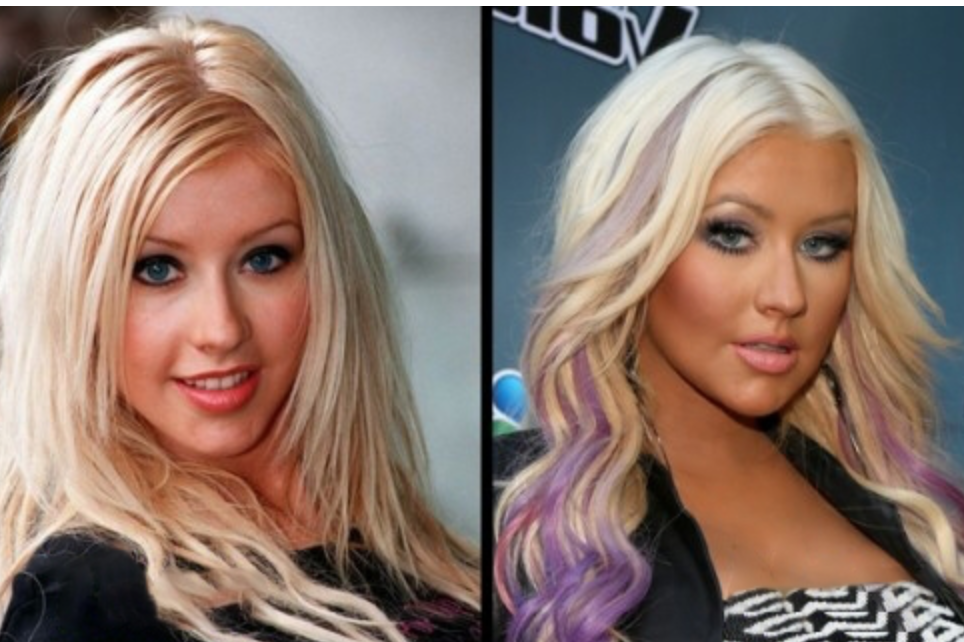 Звезды до и после пластики: найдите отличия