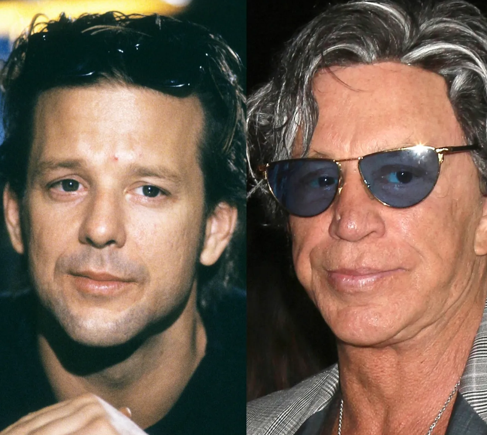 Звезды до и после пластики: найдите отличия