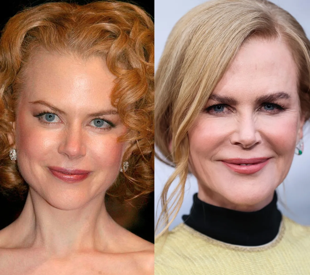 Звезды до и после пластики: найдите отличия