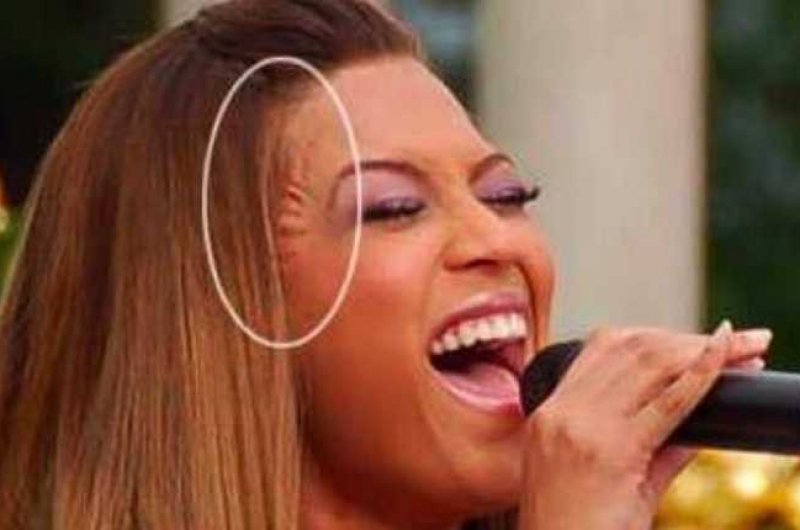 Фото знаменитостей, которые они хотели бы забыть