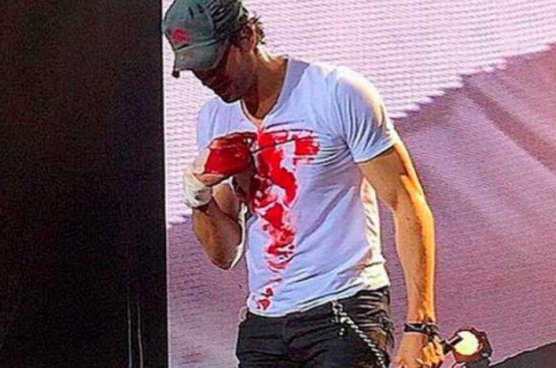 Фото знаменитостей, которые они хотели бы забыть