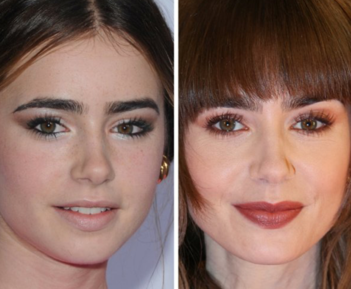 Как со временем изменились лица знаменитостей: фото крупным планом