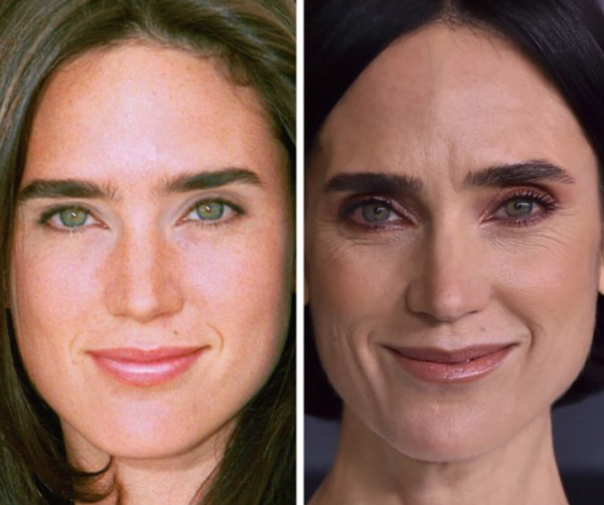 Как со временем изменились лица знаменитостей: фото крупным планом