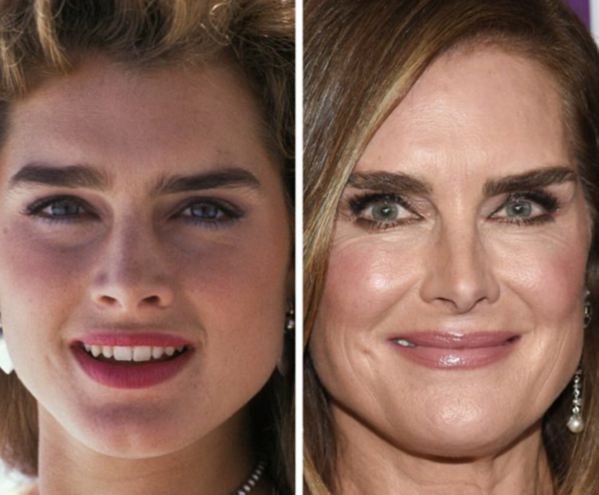 Как со временем изменились лица знаменитостей: фото крупным планом