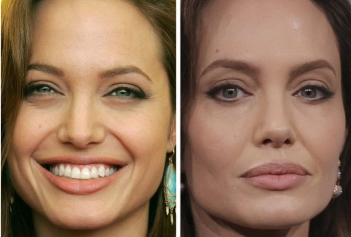 Как со временем изменились лица знаменитостей: фото крупным планом