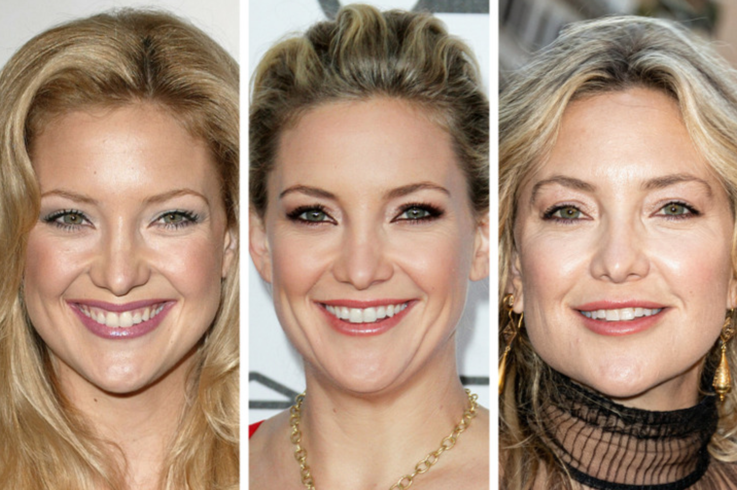 Как со временем изменились лица знаменитостей: фото крупным планом