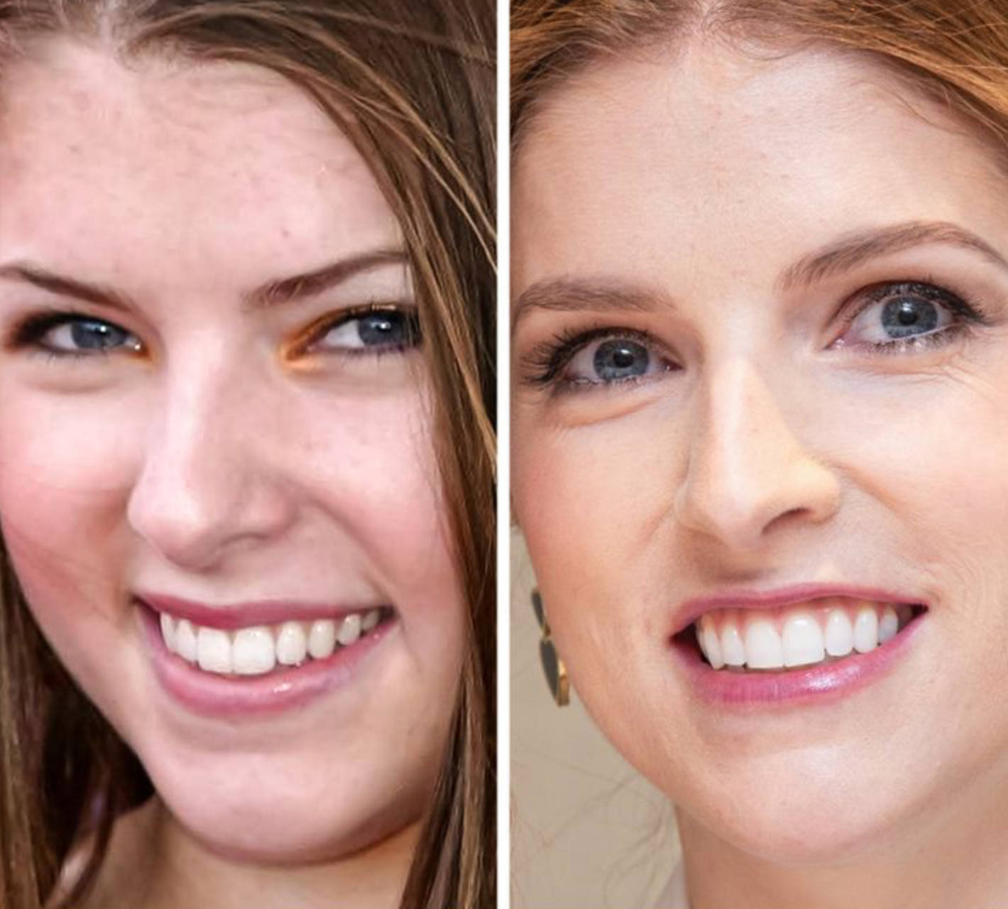 Как со временем изменились лица знаменитостей: фото крупным планом