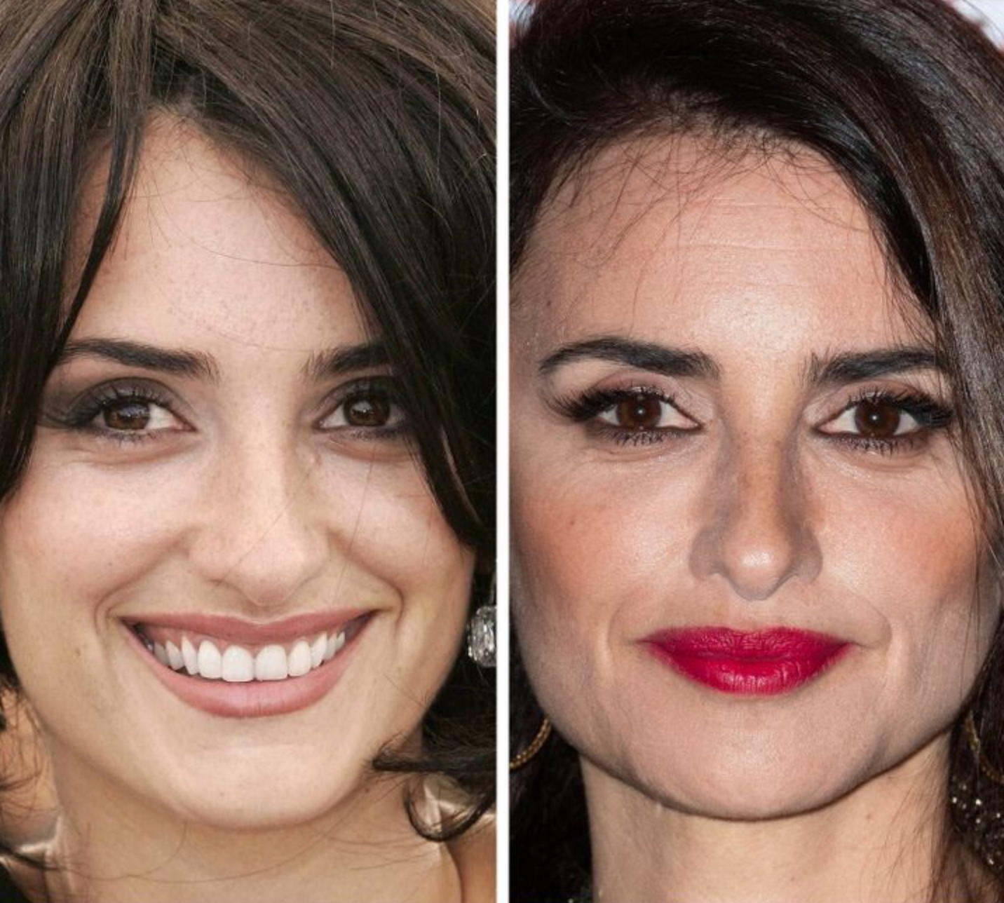 Как со временем изменились лица знаменитостей: фото крупным планом