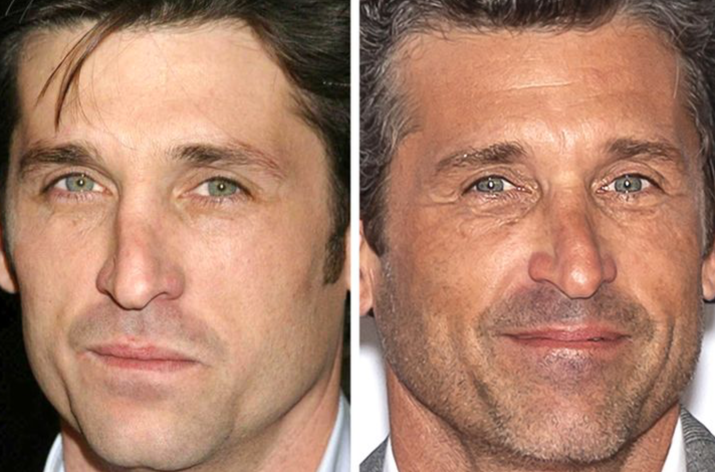 Как со временем изменились лица знаменитостей: фото крупным планом