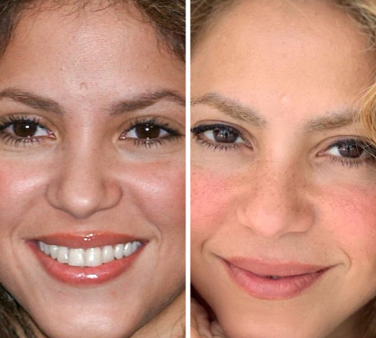 Как со временем изменились лица знаменитостей: фото крупным планом