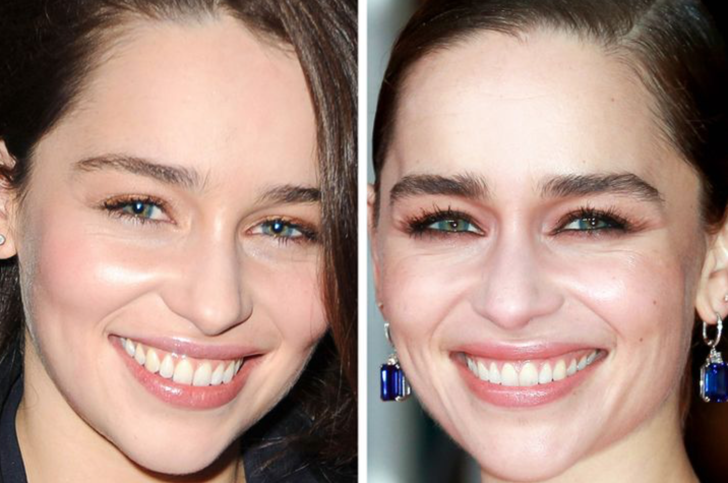 Как со временем изменились лица знаменитостей: фото крупным планом