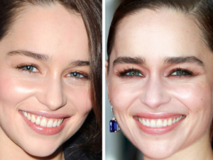 Как со временем изменились лица знаменитостей: фото крупным планом