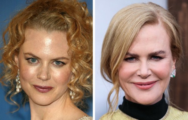 Как изменились звезды, которые возглавляли список самых красивых людей по версии People