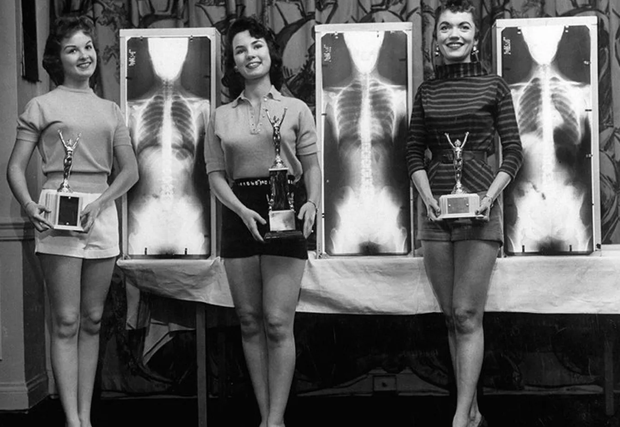 «Мисс-сосиска» и «Мисс-подгузник»: очень странные конкурсы красоты XX века