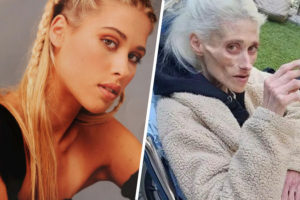 Израильская модель Карин Боуман превратилась в старуху и умерла в возрасте 35 лет (ФОТО)