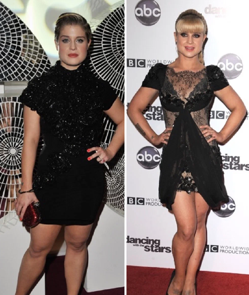 Знаменитости, които са отслабнали толкова много, че е трудно да ги разпознаете