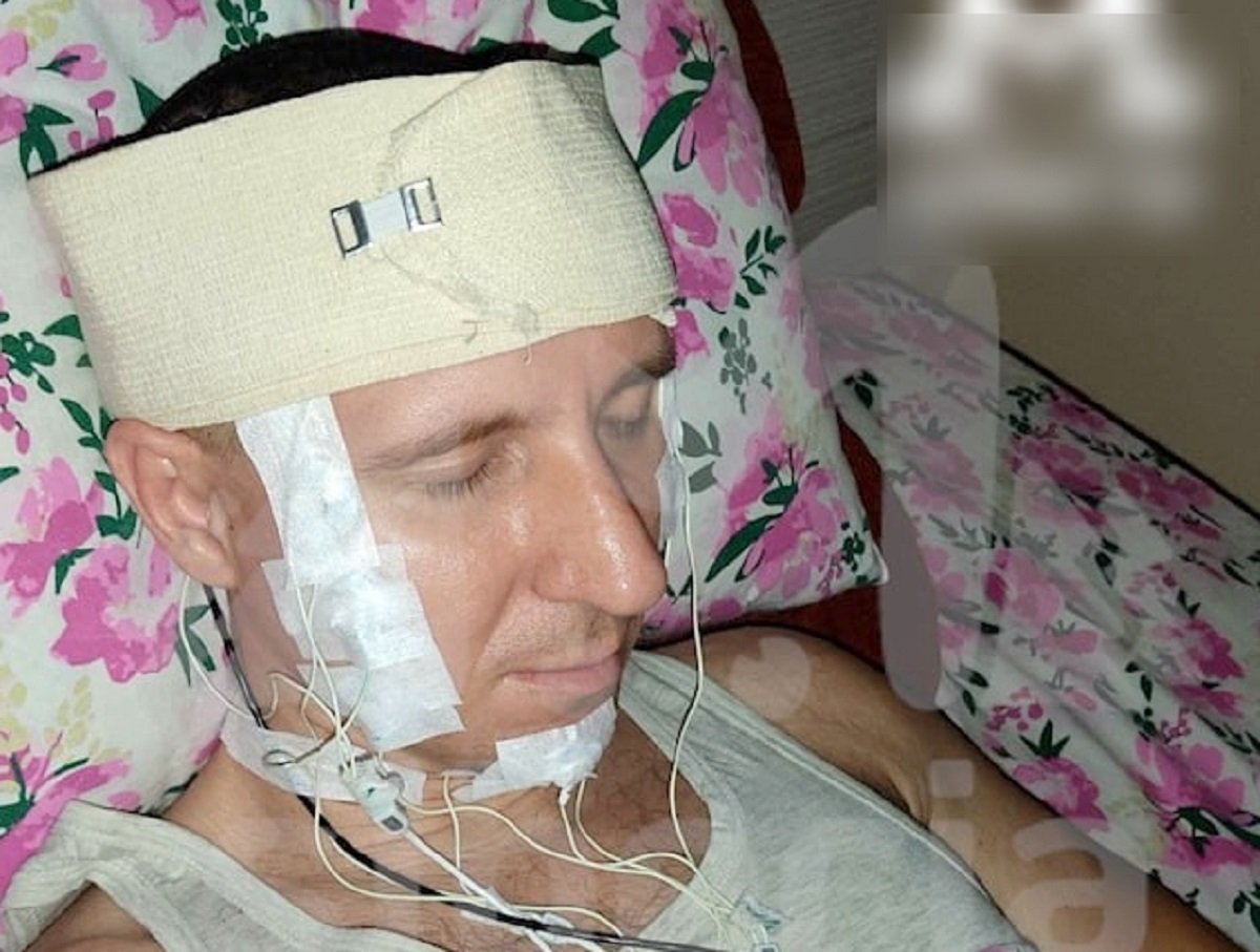 Житель Новосибирска просверлил себе череп дрелью для контроля снов
