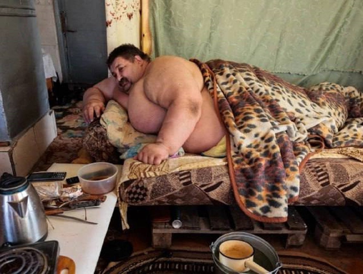 В России умер один из самых толстых людей в мире: мужчина весил 300 кило