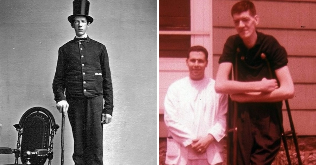 Cамые высокие люди за всю историю
