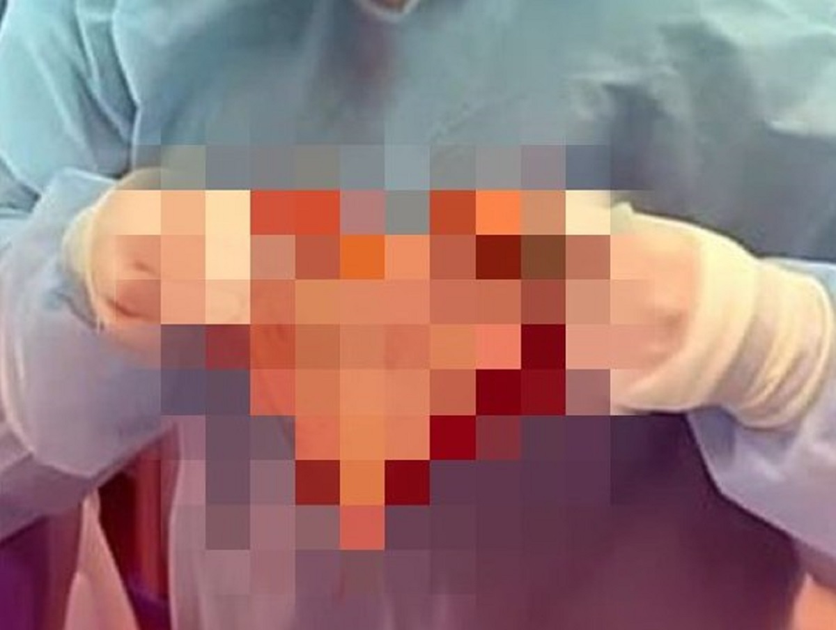 В Новосибирске хирург поздравил приятельницу «валентинкой» из кожи
