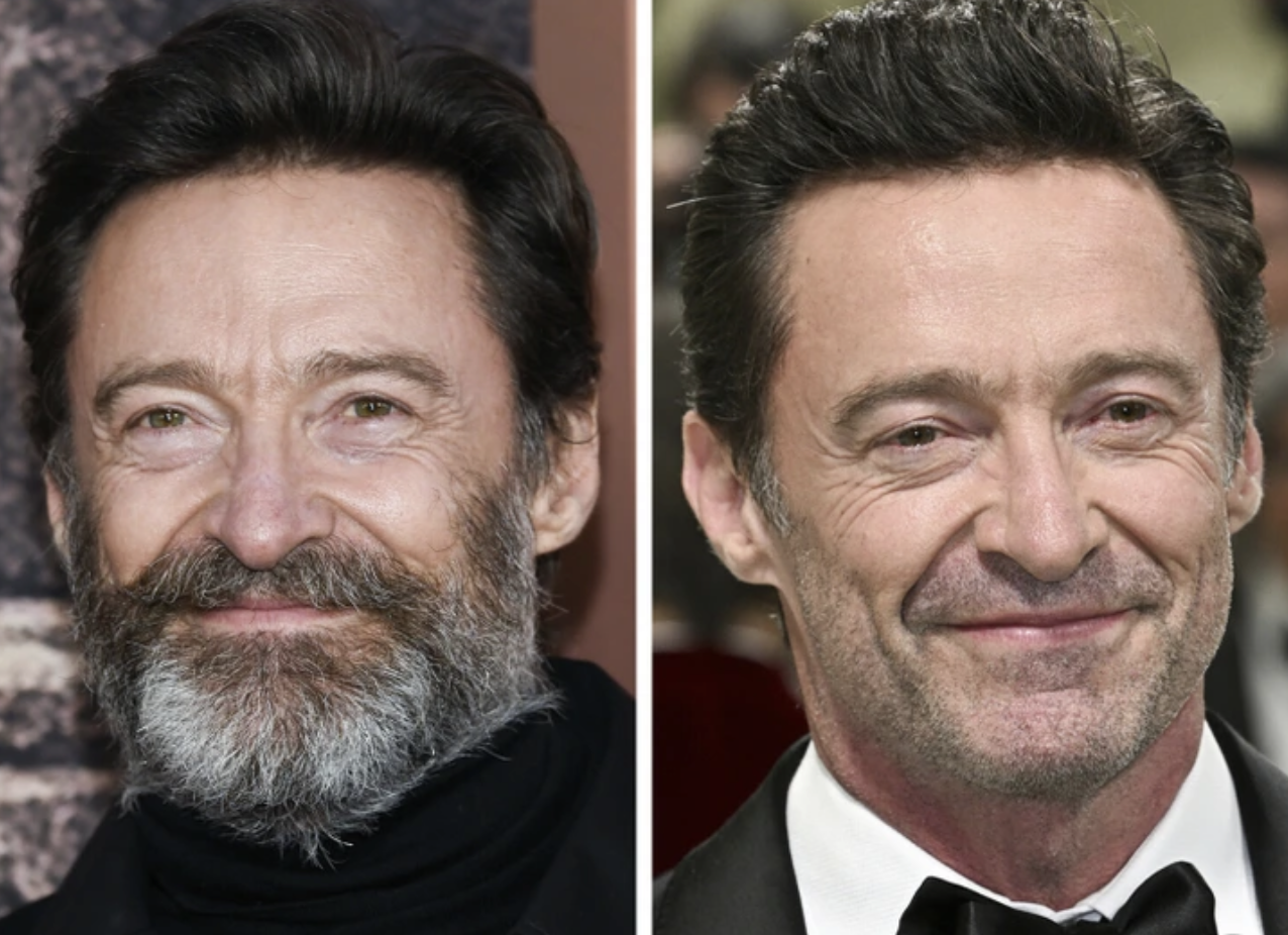 Мужчины-знаменитости которые кардинально поменяли имидж