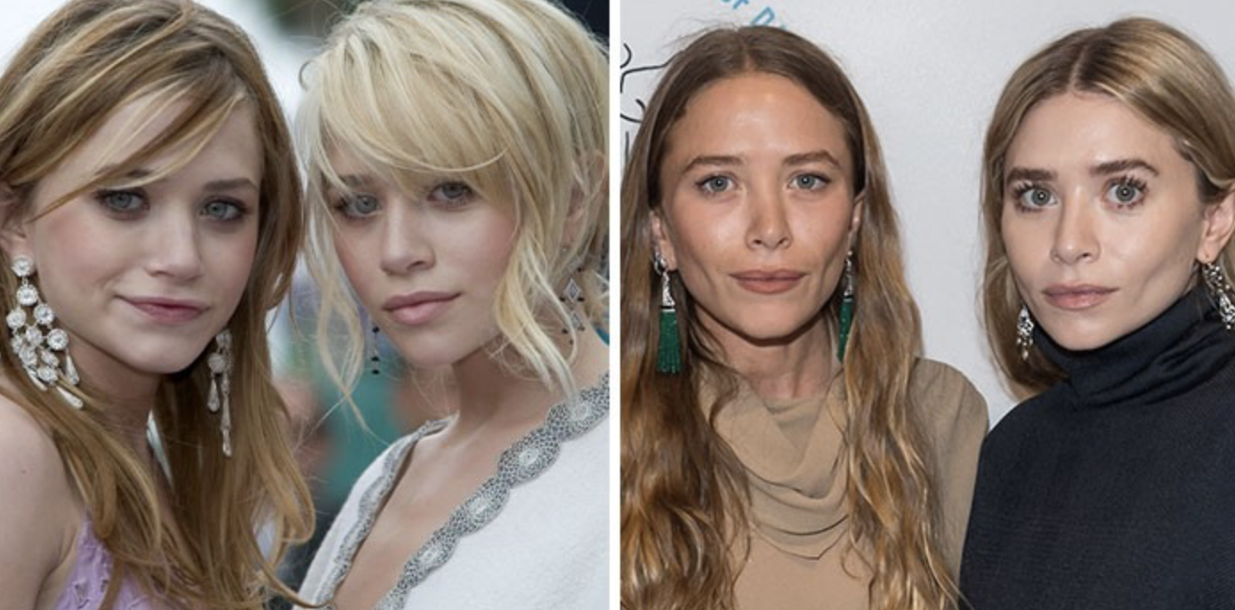 Звезды, у которых пухлые щечки превратились в красивые скулы