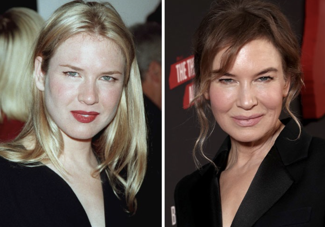 Звезды, у которых пухлые щечки превратились в красивые скулы