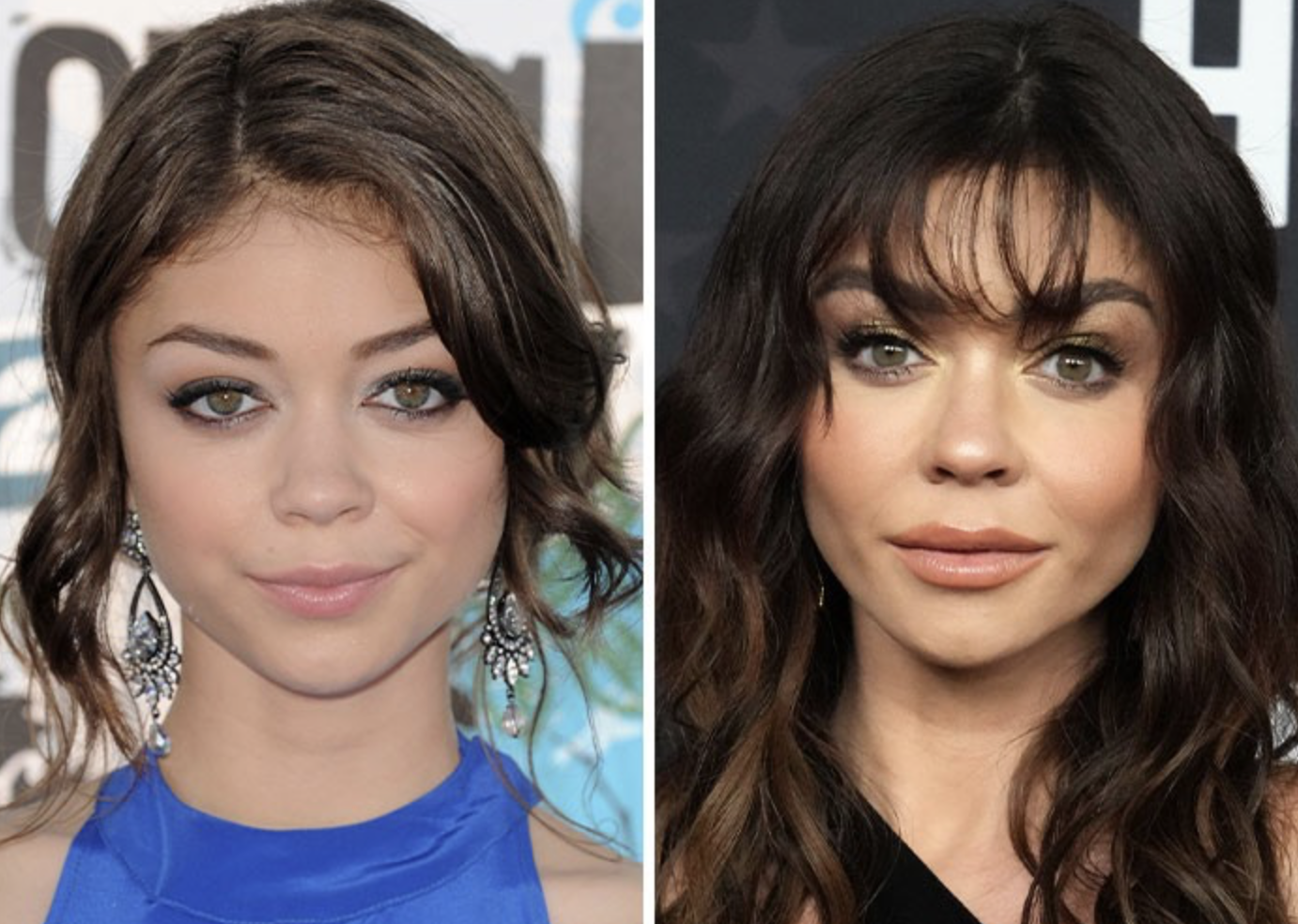 Звезды, у которых пухлые щечки превратились в красивые скулы