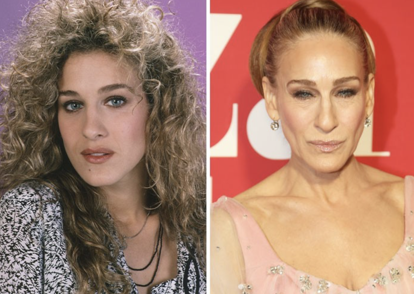 Звезды, у которых пухлые щечки превратились в красивые скулы