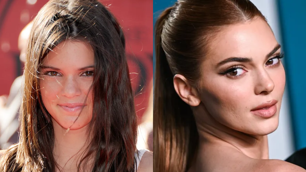 Звезды, у которых пухлые щечки превратились в красивые скулы